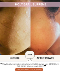 MURSHMALLOW HOLY GRAIL SERUM SUPREME [Multi-active Moisturiser]